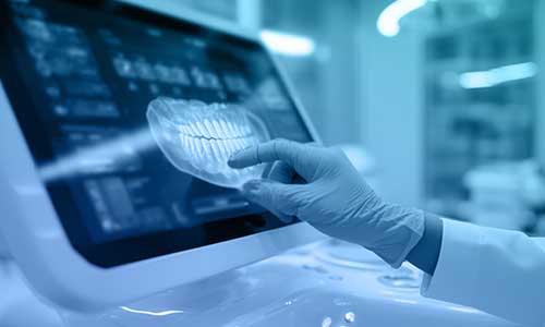 Verident-scanner-intraorale-digitale-